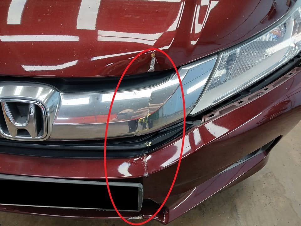 Front bumper of the Honda City with damage beside the grille circled in red.